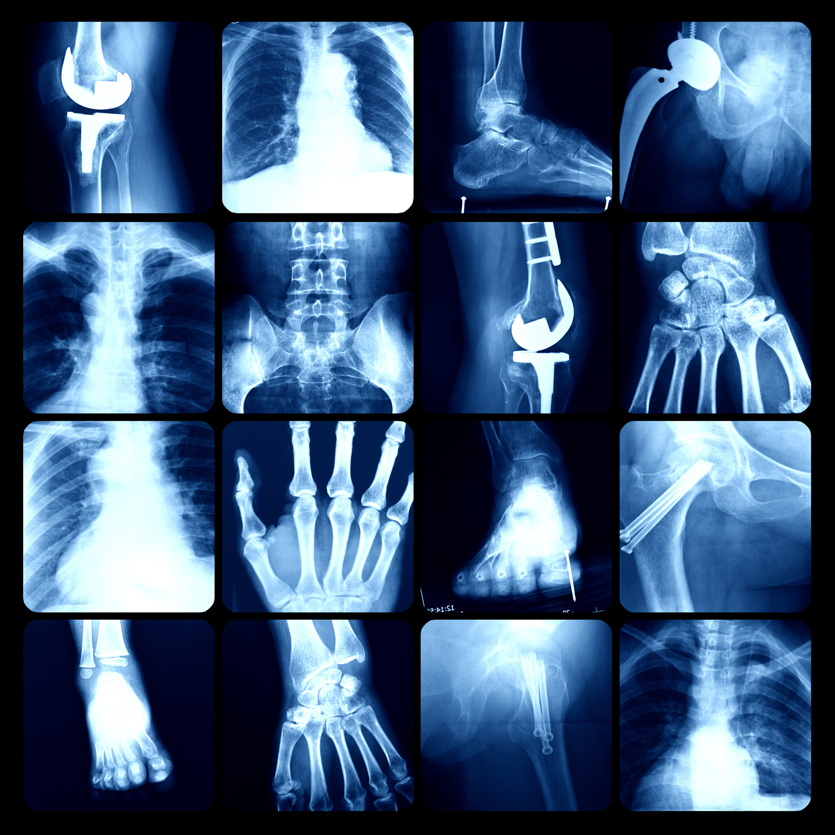 x-ray